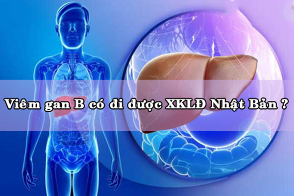 Viêm Gan B Có Đi XKLĐ Nhật Bản Không